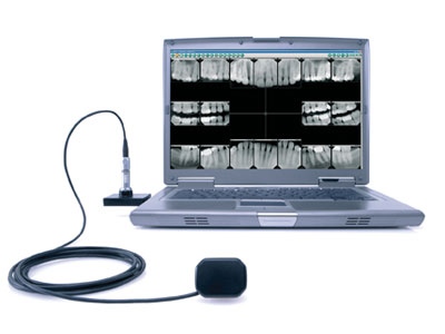Digital_Dental_X_rays.jpg