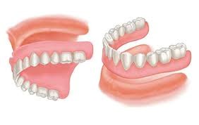 dentures-2.jpg