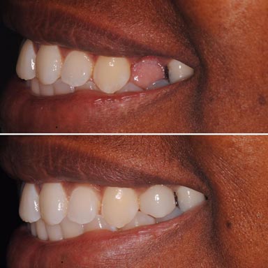Modern Dental Smiles Dr Kurt O. Bally