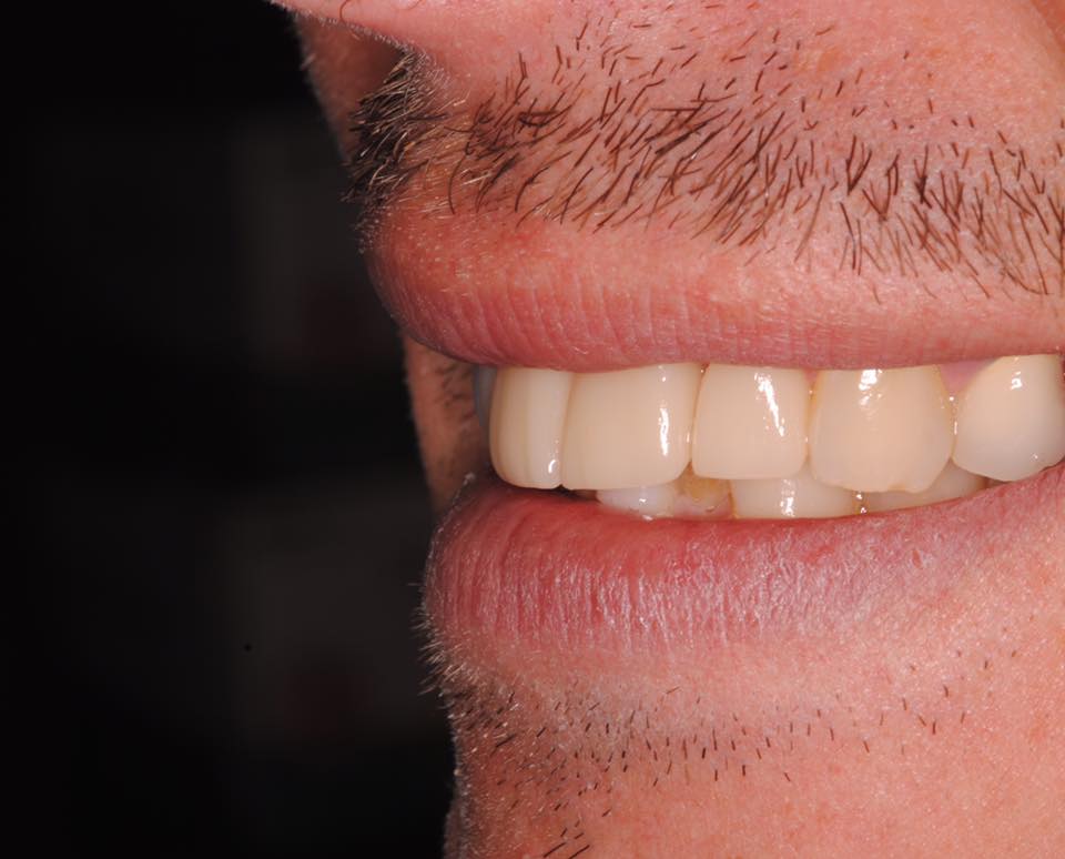 Modern Dental Smiles Dr Kurt O. Bally