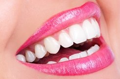 Teeth bleaching and whitening by Yavner Dental Associates in Medford, MA